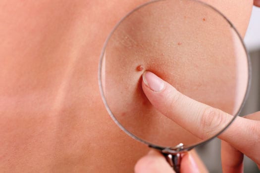 Skin-genius-cosmetic-dermatology-treatments